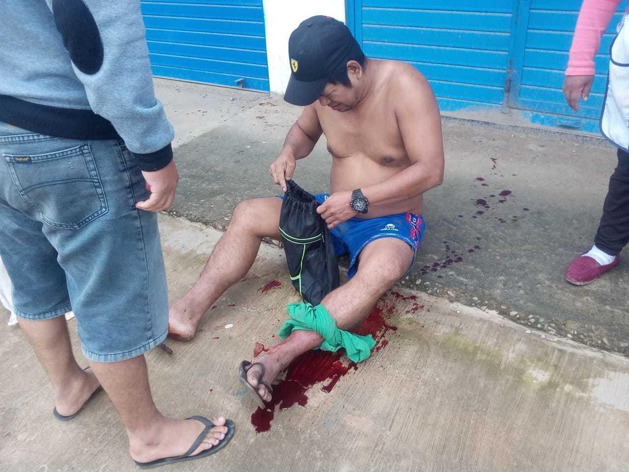 Puerto Maldonado: Acribillan a hijo de empresario pesquero